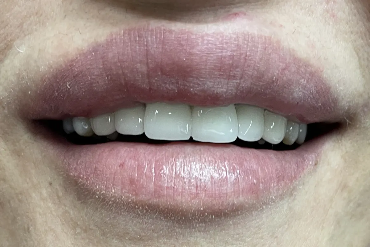 6